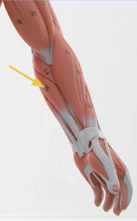 <p>flexor carpi radialis m.</p><p>O: Medial epicondyle of humerus<br>I: Base of 2nd and 3rd metacarpals<br>A: Flexes wrist, radial deviation<br>Inn: Median n.</p>