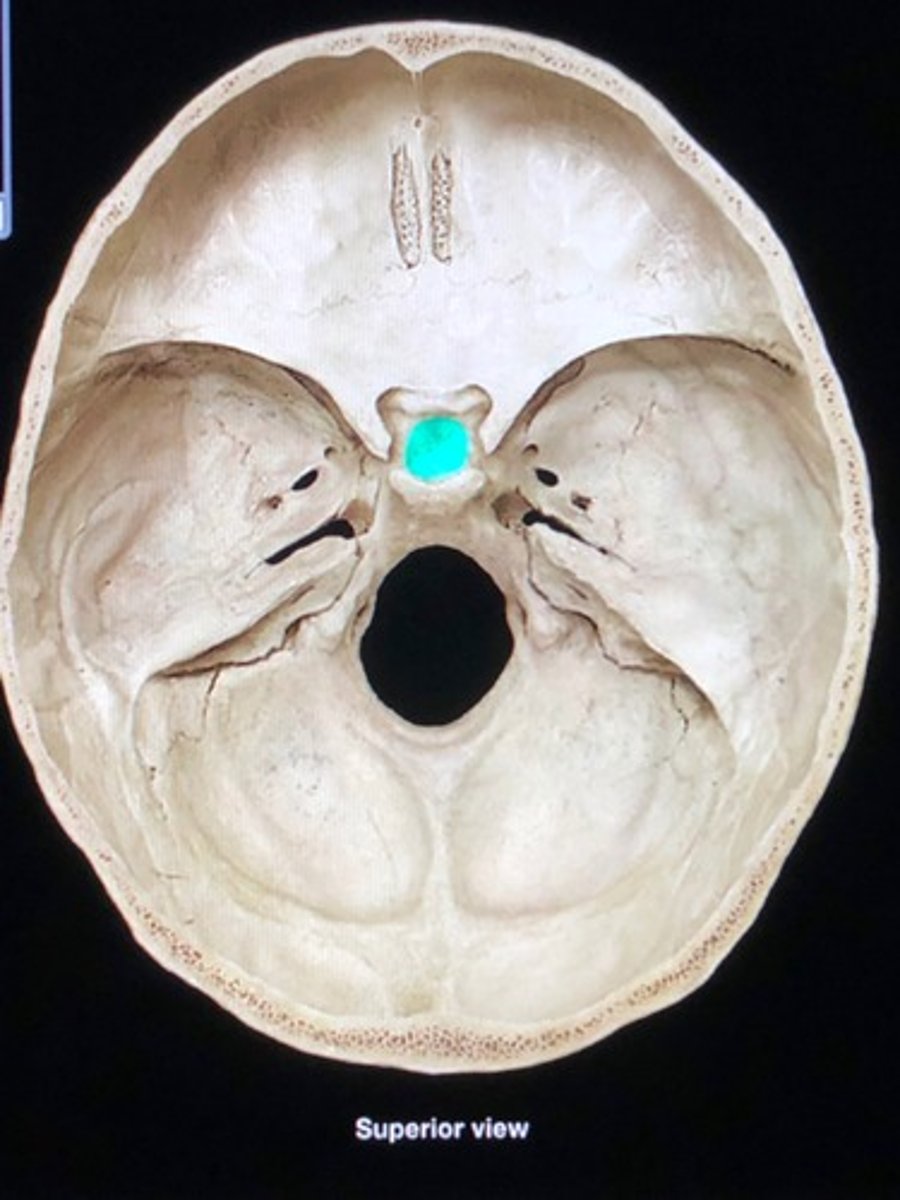 <p>the depression of the sella turcica; home of the pituitary gland</p>