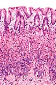 <p>What tissue is this</p>