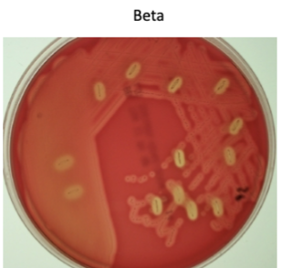 <p>gets a clearing around the colonies due to compete lysis, S.<br>pyogenes which causes strep throat- it is a group A strep because it has the A carbohydrate</p>