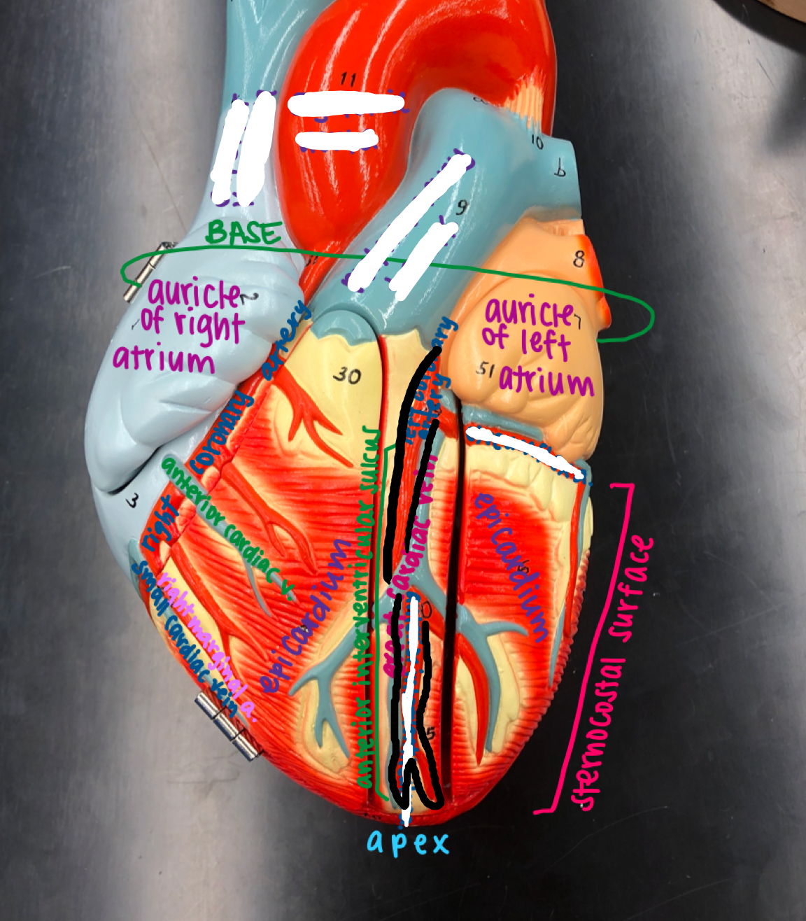 <p>The middle red artery below the great cardiac vein leading to the apex</p>