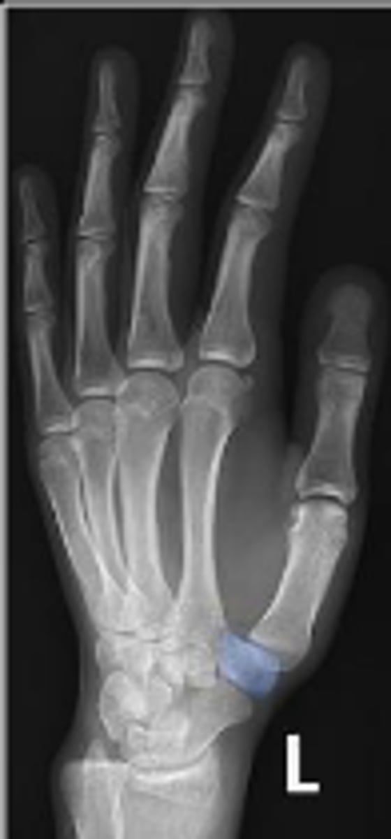 <p>What is outlined?</p>