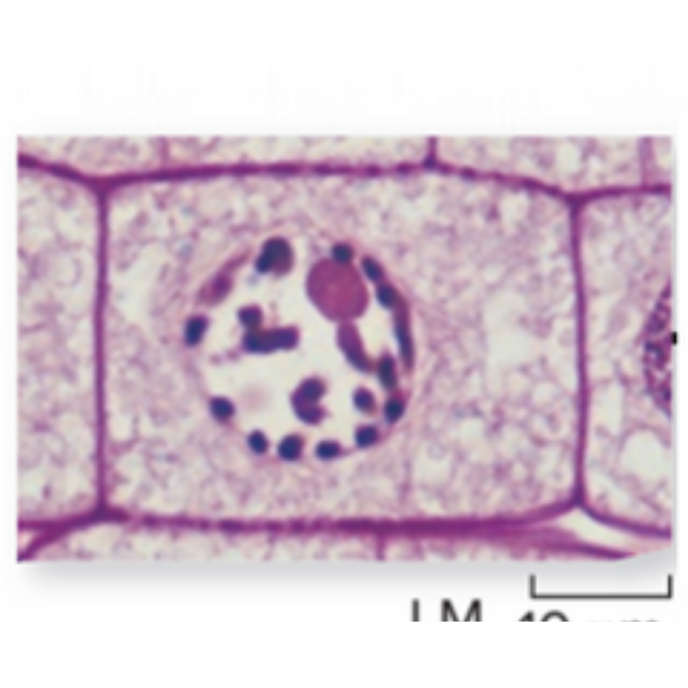 <p>What kind of cell is shown? Name the phase that it is experiencing.</p>