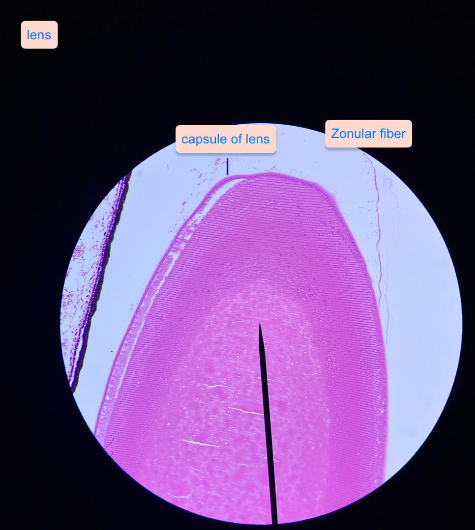 <p>Left- lens capsule Right- zonular fibers</p>