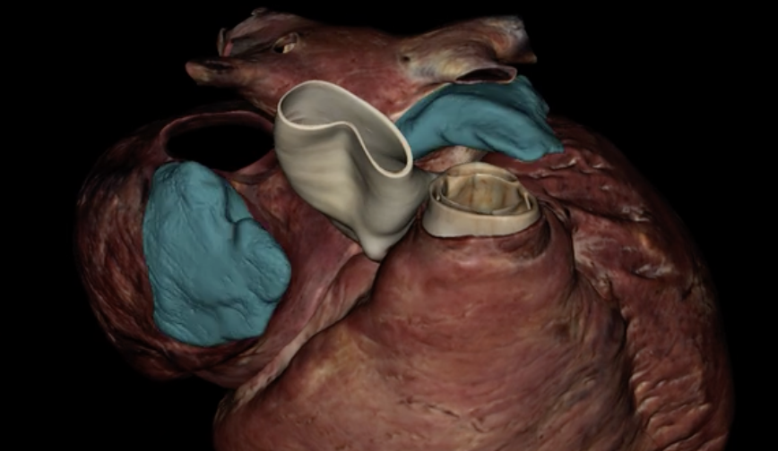 <p>What is highlighted in turquoise?</p>