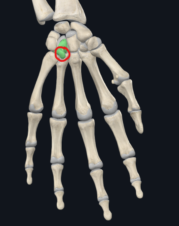 <p>What is this</p>