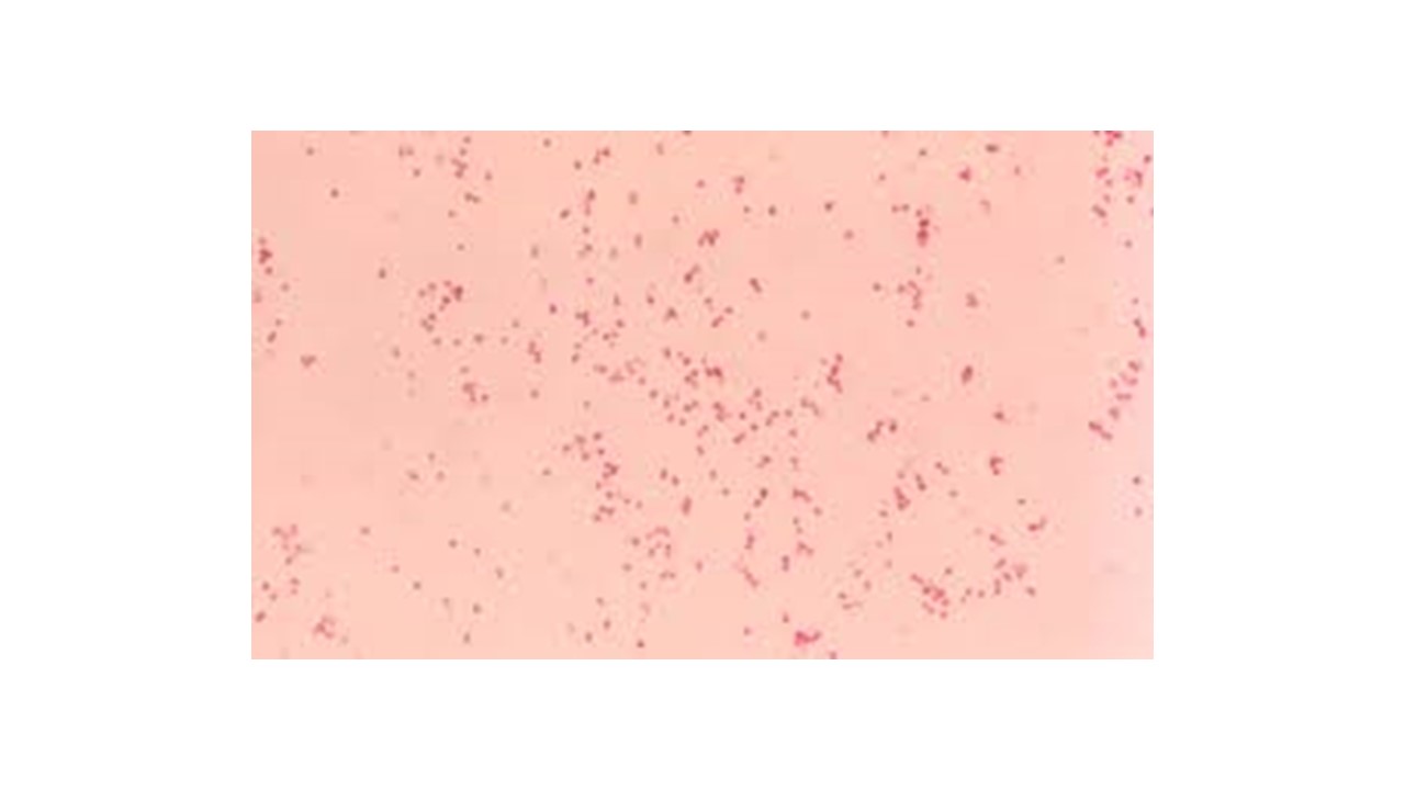 <p>gram negative&nbsp;</p>