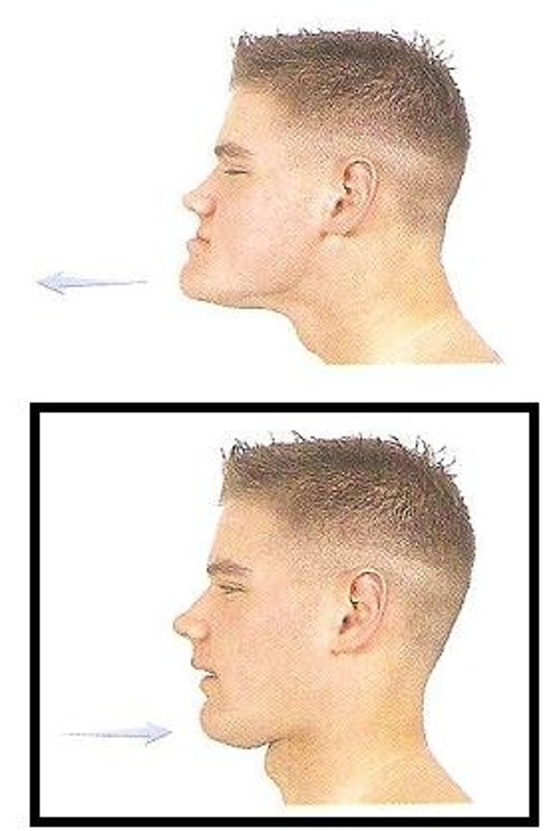 <p>Posterior movement of the mandible.</p>