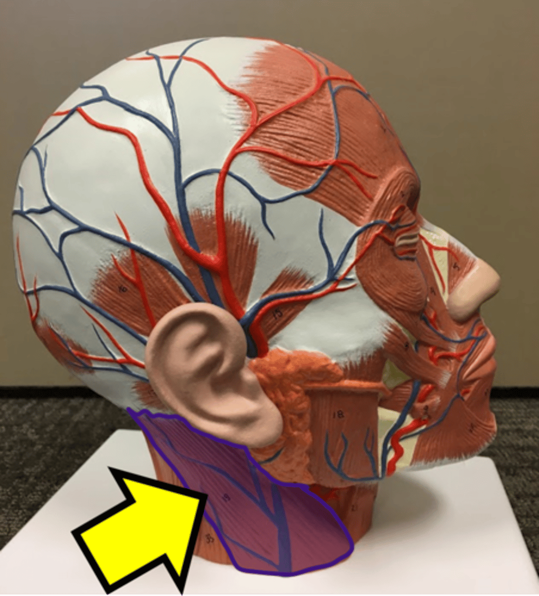 <p>Name the muscle.</p>