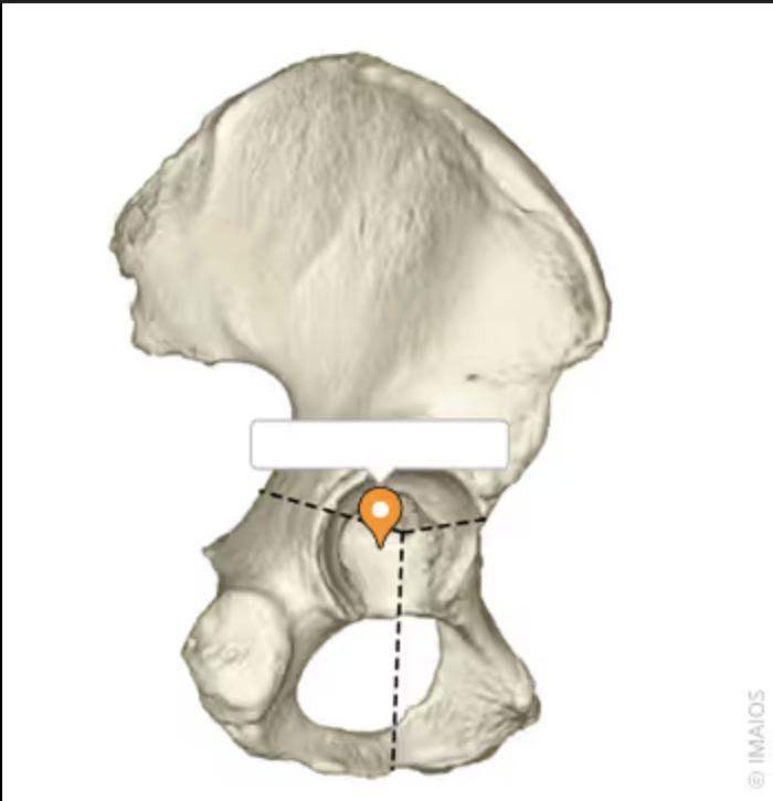 <p>this dish/socket for the femur to sit</p>