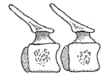 <ul><li><p>anterior concave</p></li><li><p>posterior convex</p></li></ul><p></p>