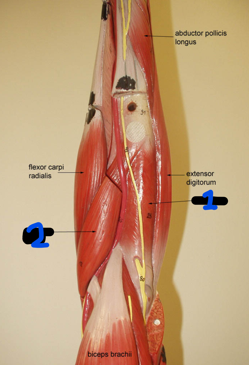 <p><span style="font-family: Arial, sans-serif">What are the actions of the muscle found at 1?</span></p>