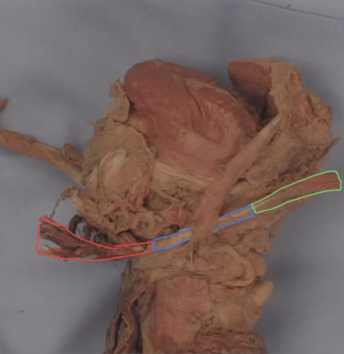 <p>identify structure outlined in blue</p>