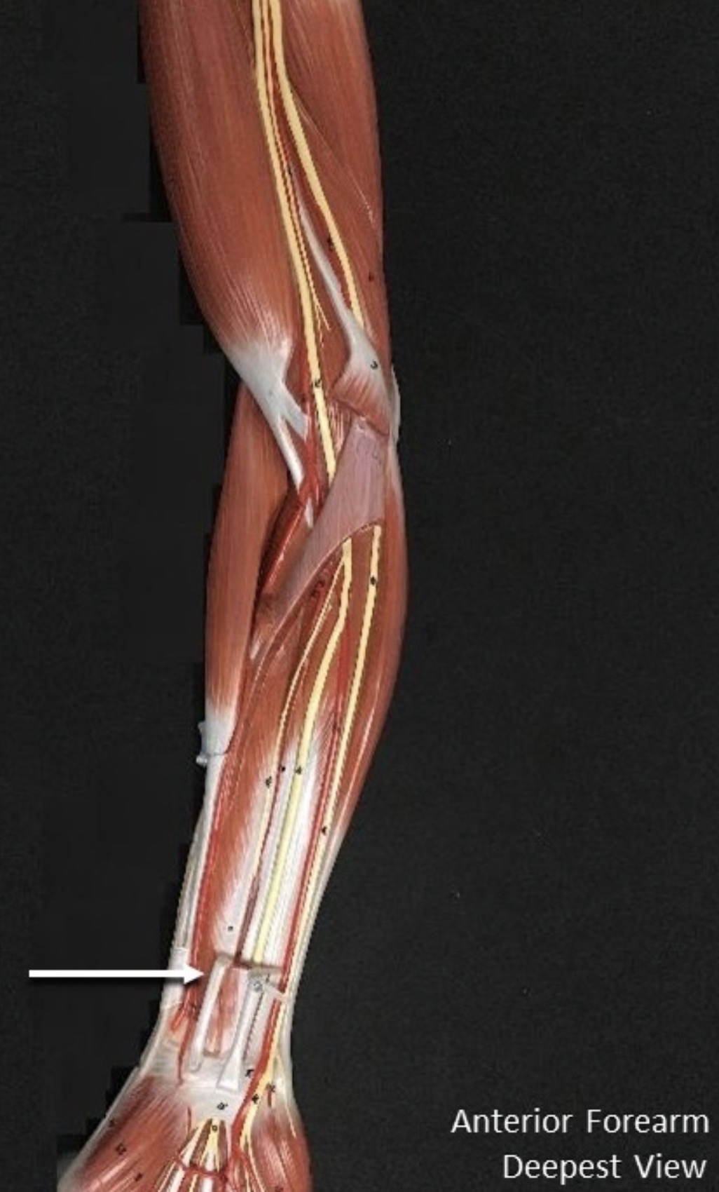 <p><span>Name the muscle labeled with the white arrow below.</span></p>