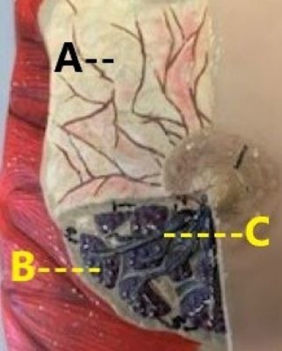 <p>A</p>