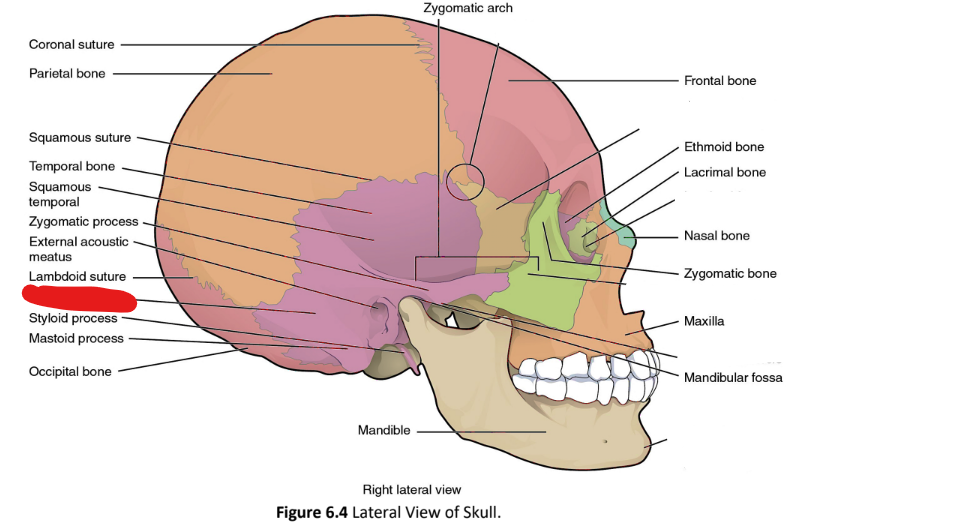 term image