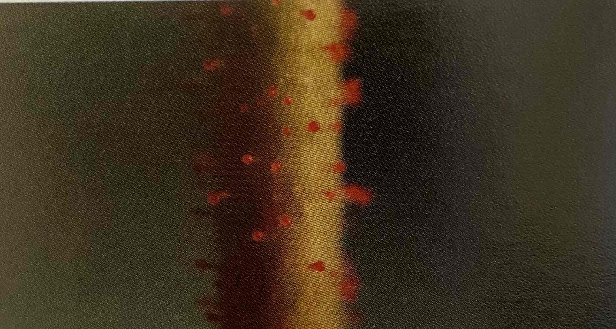 <p>Trichomes </p>
