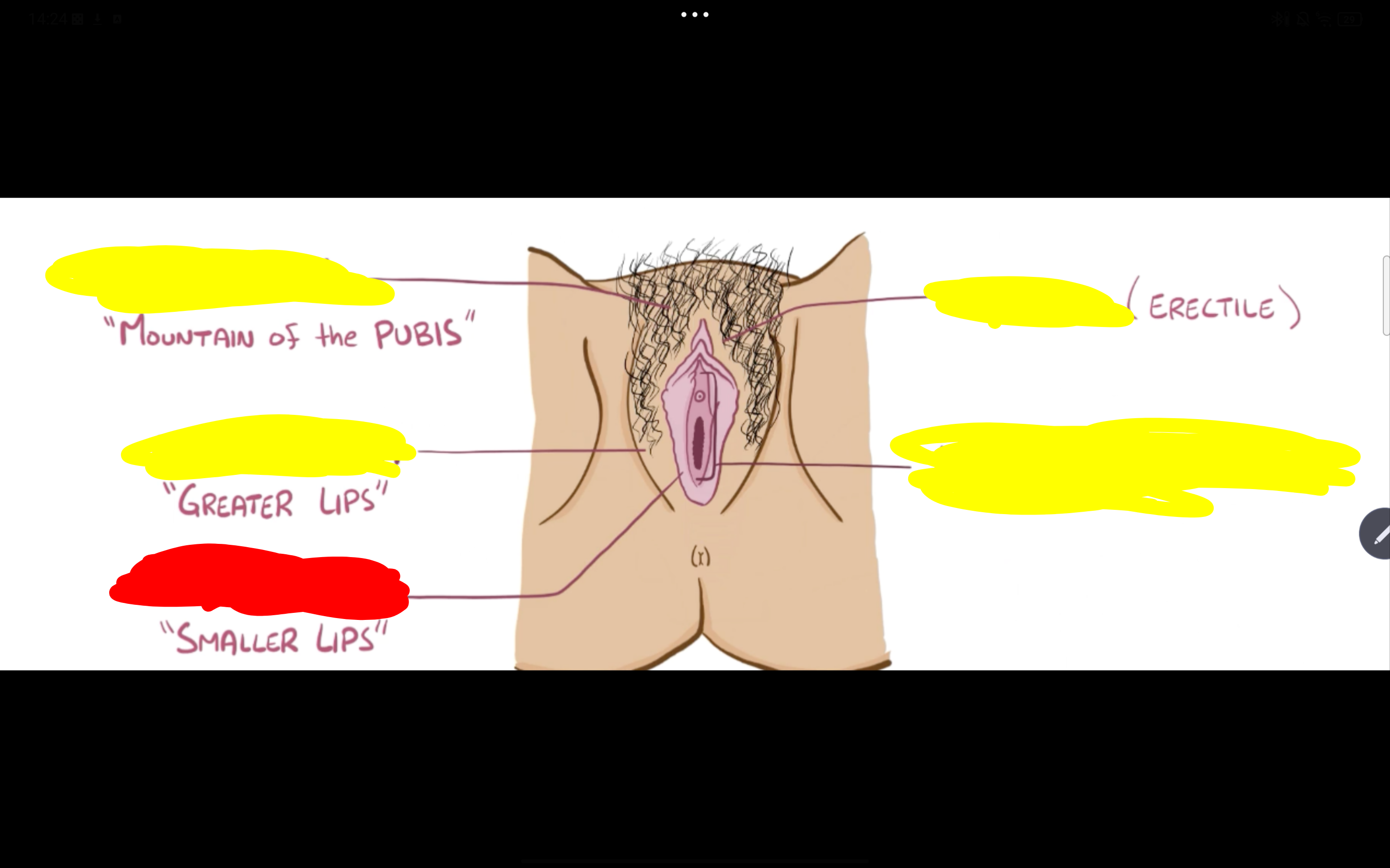 <p>Name the structure in red</p>