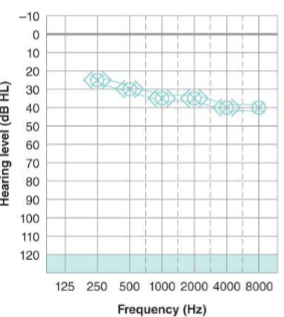 <p>What type of hearing loss is this and what are the results?</p>