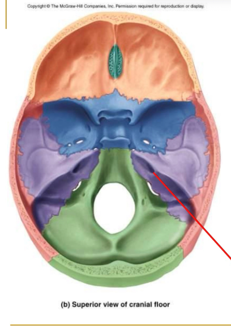 <p>What nerve canal is this?</p>