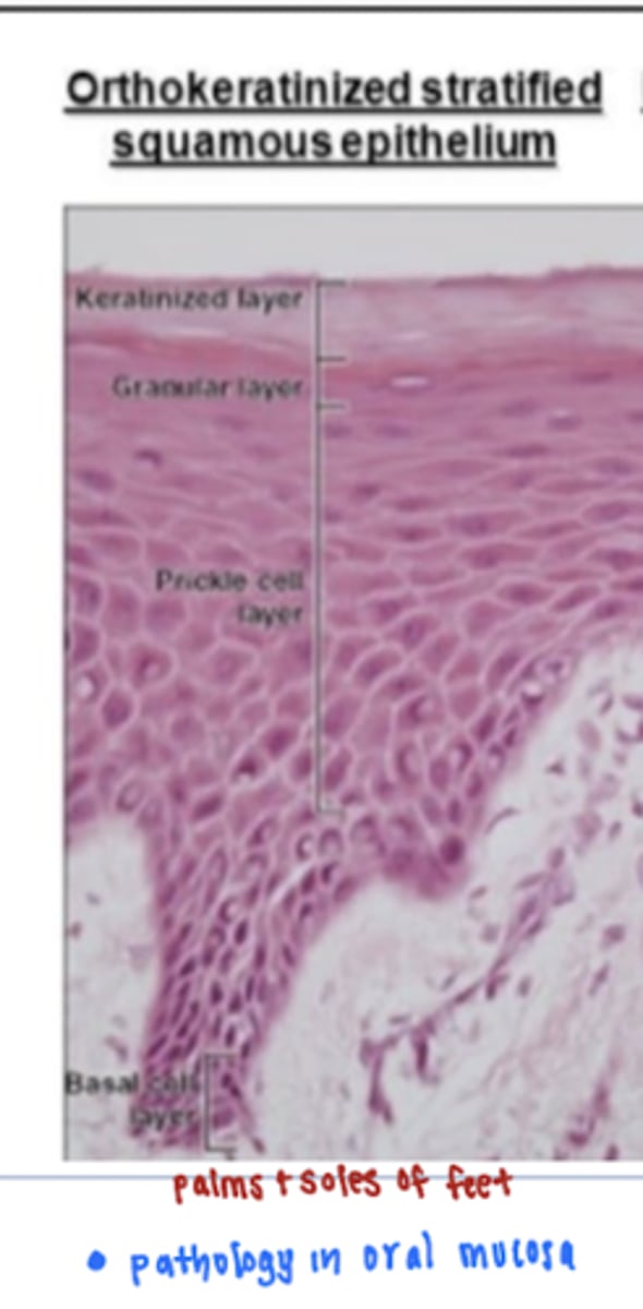 <p>false, orthokeratinized epithelium is abnormal in the oral cavity </p><p>*normally located on soles of palms and feet</p><p>-orthokeratinized epithelium is epithelium that shows extensive keratin formation and surface cells are non-nucleated </p>