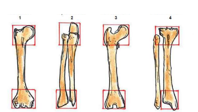 <p>Klassifikation nach AO</p><p></p>