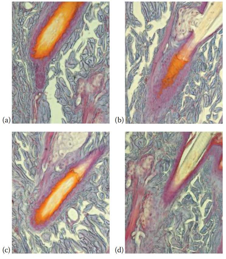 Longitudinal section view of a scalp hair follicle during the hair cycle. (a) Early anagen, (b) full anagen, (c) catagen, and (d) telogen.