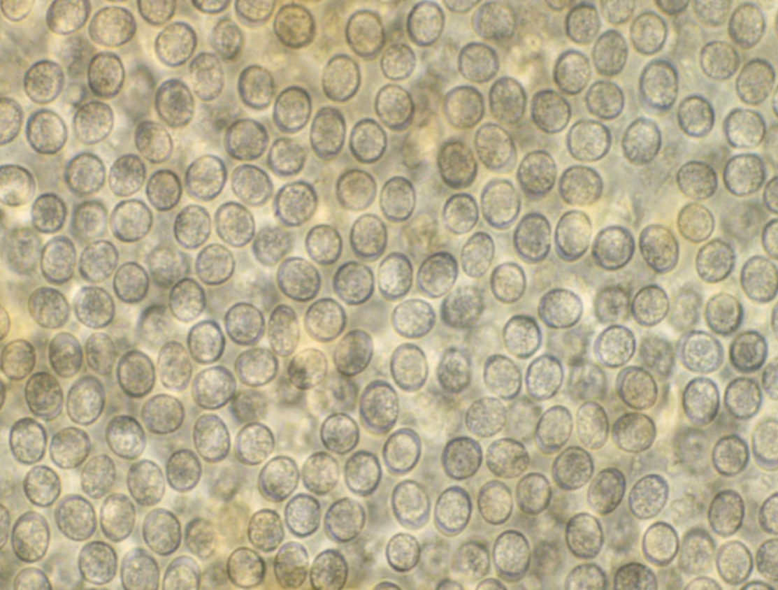 <p>A stray cat comes into your clinic experiencing diarrhea, sneezing, coughing, and lymphadenopathy. Organisms measuring approximately 12 micrometers like those in the image are seen on fecal examination. What is the diagnosis?</p>
