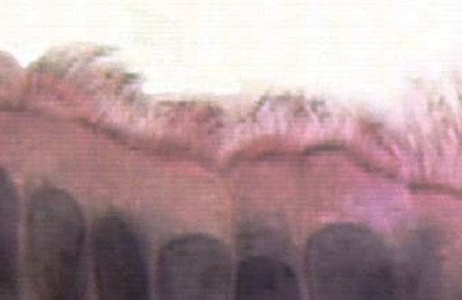 <p>What apical surface?</p>