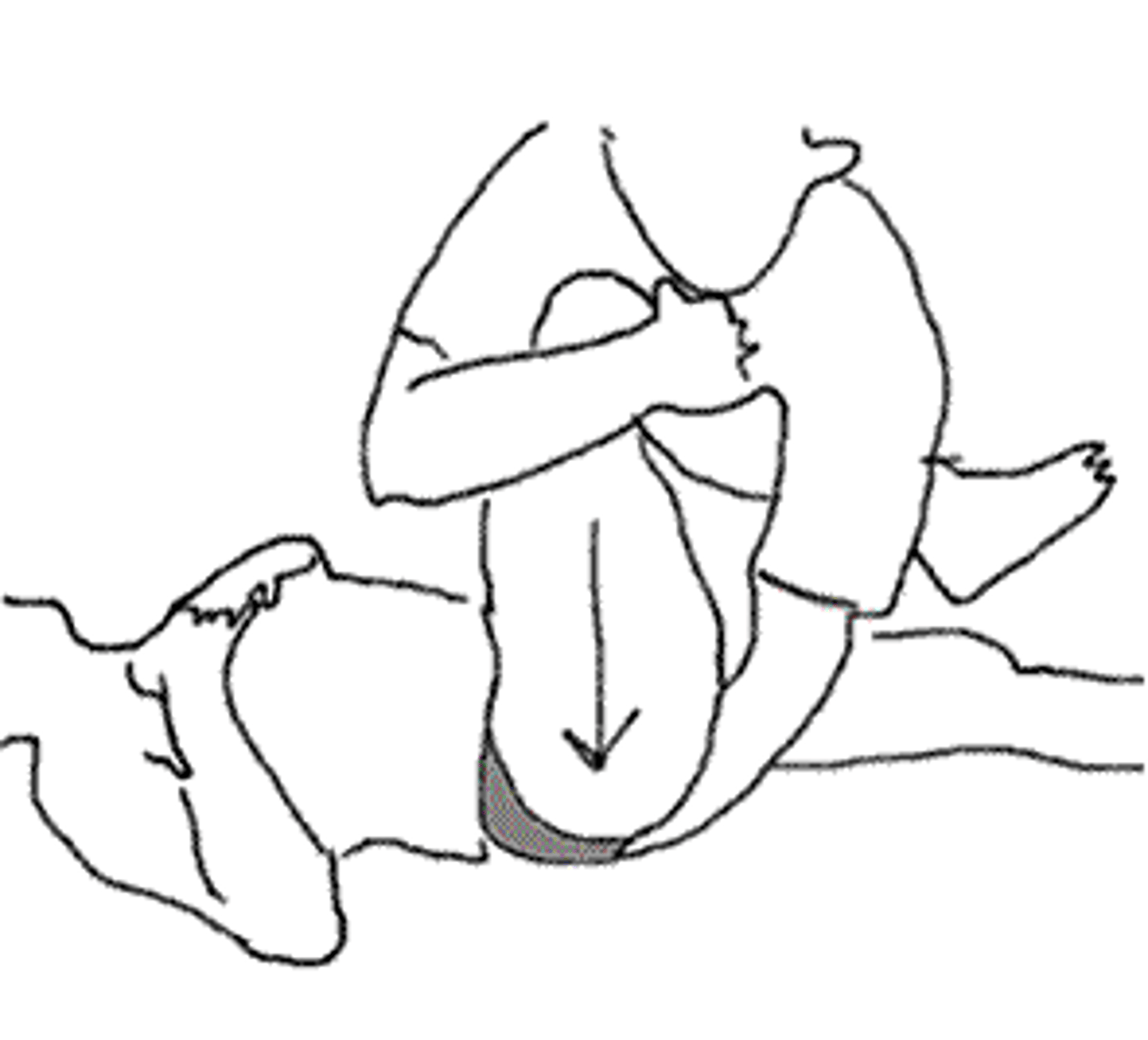 <p>___Pt is supine &amp; examiner passively flexes hip to 90 degrees</p><p>___One hand palpates the SI joint while the other hand thrusts (pushes) down through the knee and hip (long axis compression)</p><p>___Bilaterally performed</p><p>___Positive finding: SIJ pain on the same side</p><p>___Indication: SIJ syndrome</p>