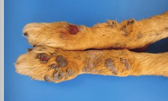 <p>inherited mutation leading to overproduction of folliculin--> forms dense nodules of collagen</p>