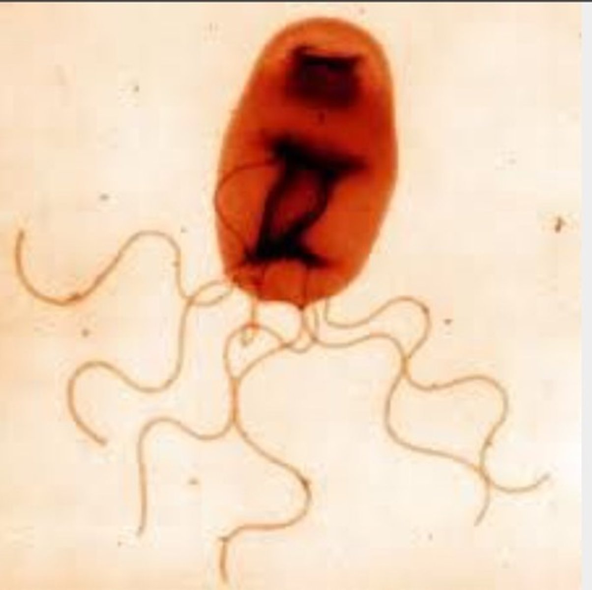 <p>Bartonella henselae.</p>