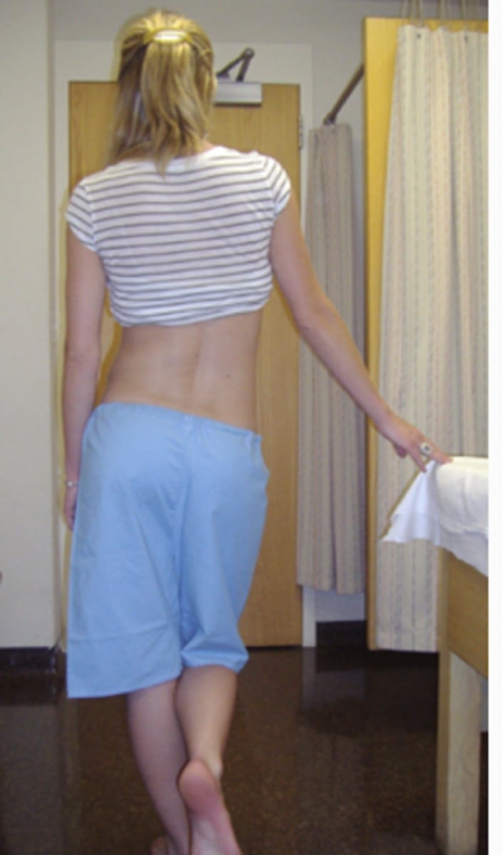 <p>frontal plane, preventing contralateral hip drop</p>
