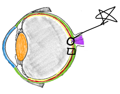 <p>Optic disc</p>