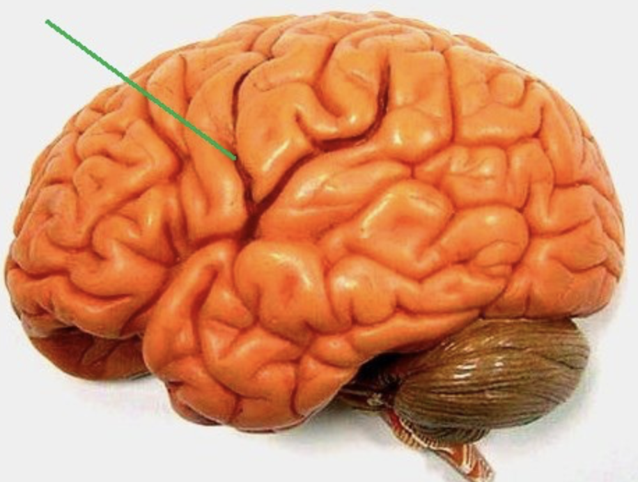 shallow grooves (brain convolutions)
