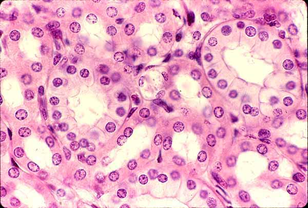 <p>What type of epithelium is indicated by the green arrow?</p>