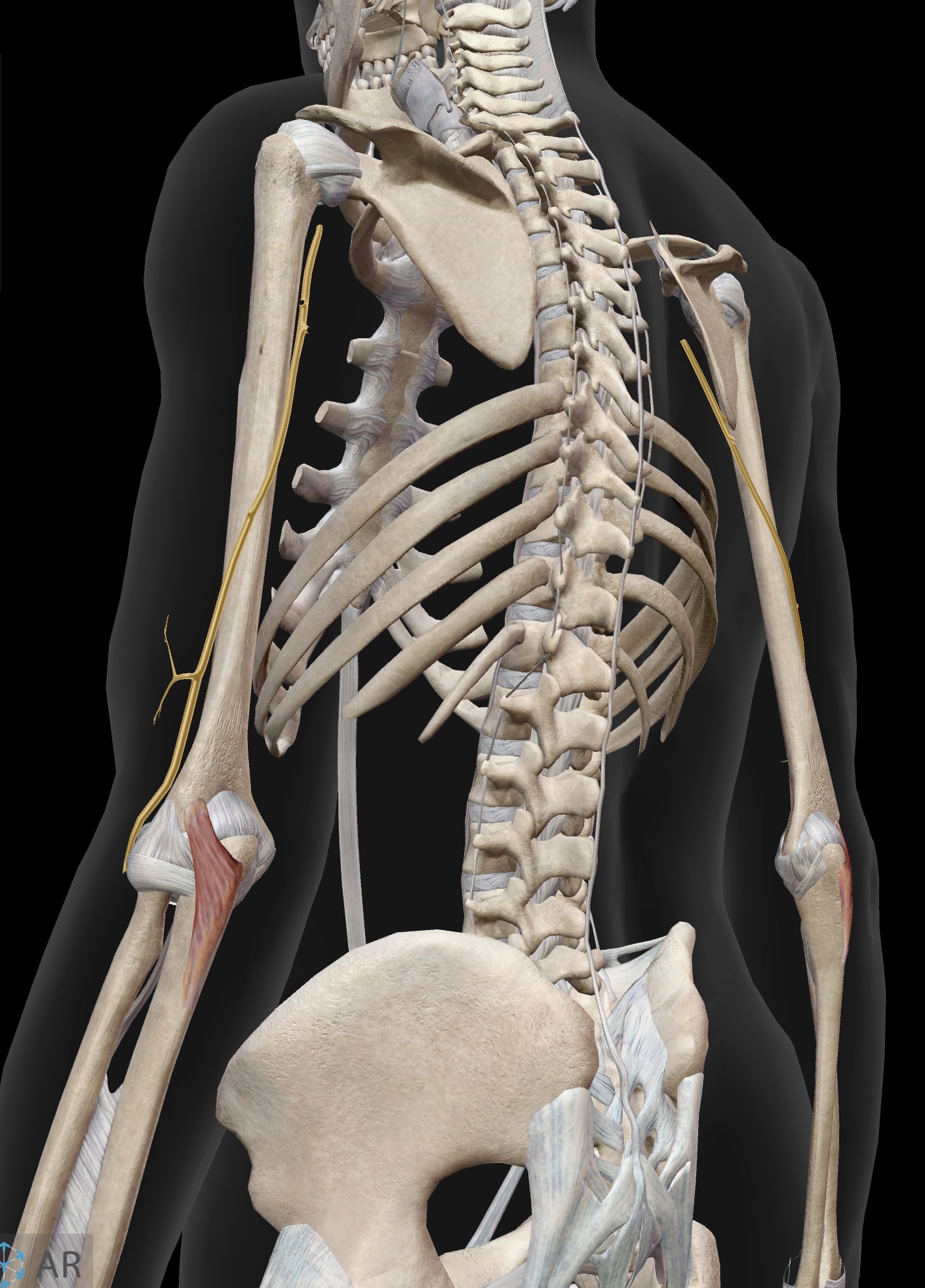 <p>Anconeus</p><p>O: Lateral epicondyle of humerus</p><p>I: Olecranon process of ulna (inferior to insertion of triceps)</p><p>A: Extension of forearm at elbow joint (end of range extension). Synergist to triceps for elbow extension.</p><p>IN: Radial nerve (C5-C8, T1)</p>