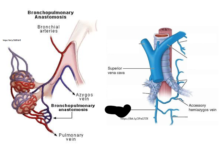 <p>What Artery is this?</p>
