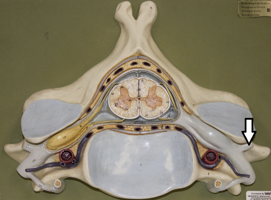 <p>identify the structure</p>