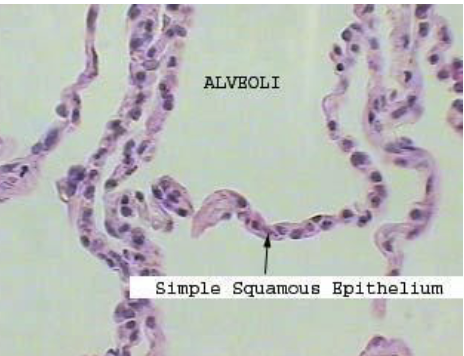 <p></p><p>squamous </p>