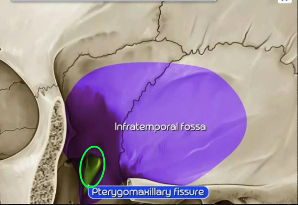 <p><strong>Laterally, </strong>the pterygopalatine fossa communicates with the _____ via <strong>pterygomaxillary fissure</strong></p>