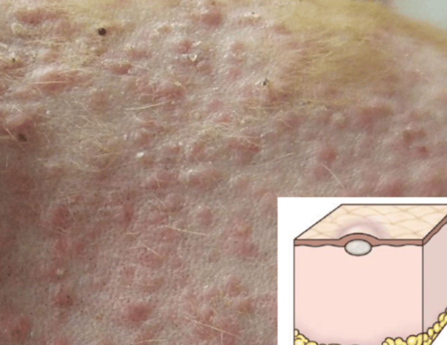 <p>What lesion is this? Is it primary or secondary?</p>