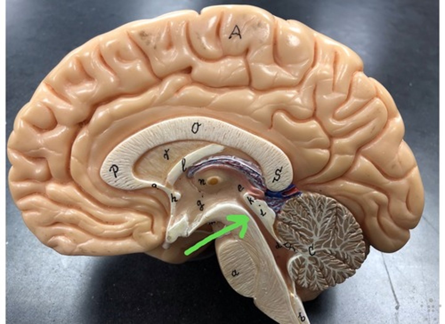 <p>connects the third and fourth ventricles</p>