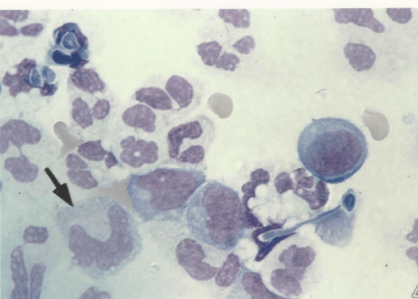 <p>Identify the cells in this body fluid</p>