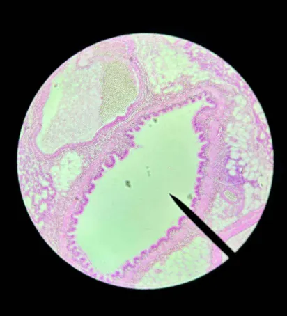 <p>Where is this tissue from?</p>