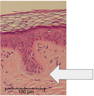term image