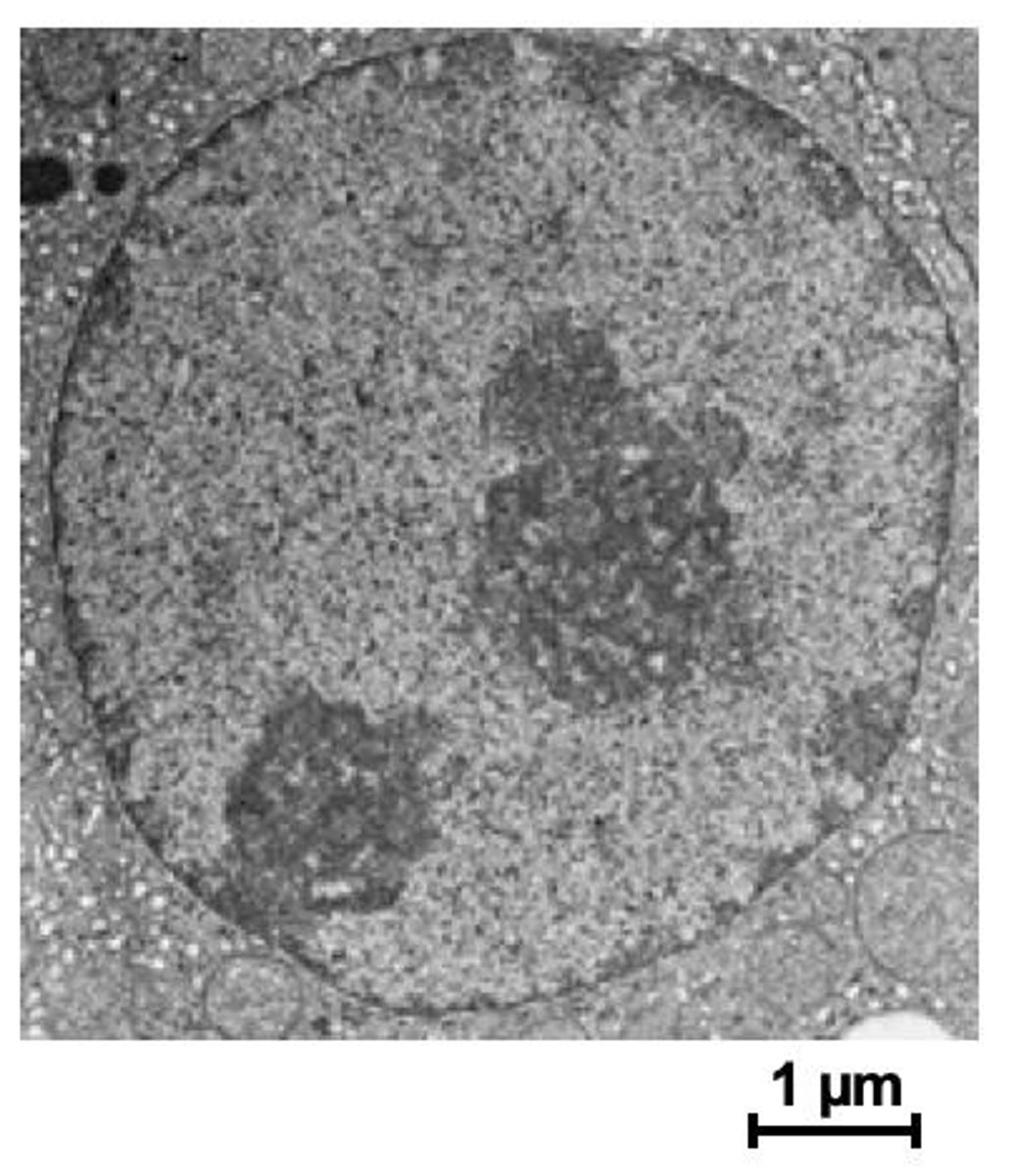 <p>The nucleolus is a dense region in the nucleus where ribosome assembly occurs.</p>