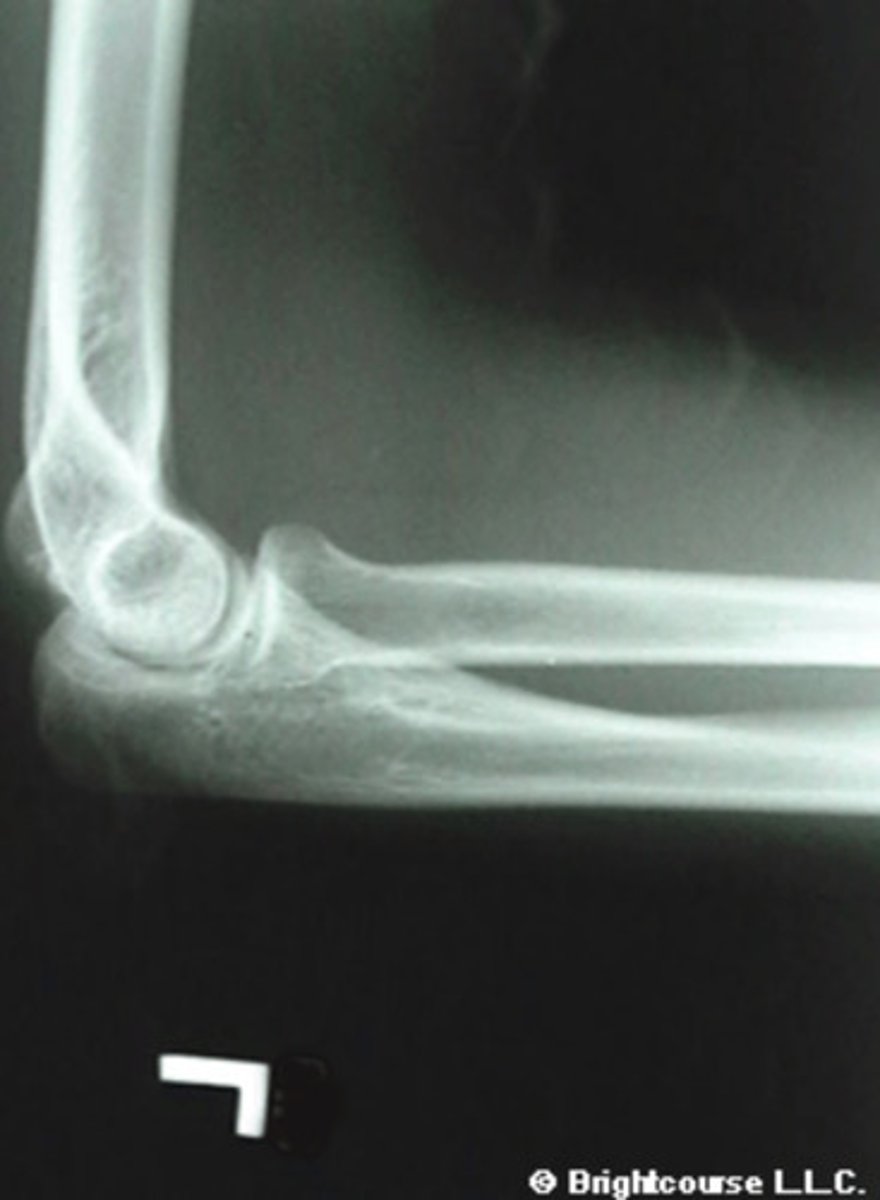 <p>What is the name of the radiographic projection?</p>