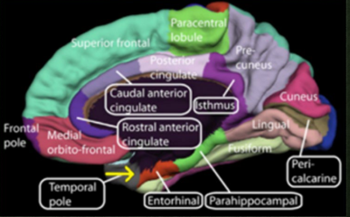 <p><strong>Alzheimer Disease (AD)</strong></p><p>-The most common early symptom of Alzheimer’s is difficulty ____________ _____ learned information</p><p>-Alzheimer changes typically begin in the part of the brain that affects _________</p><p>-Begins in the __________ region of the medial _______ lobe, spreading to the ____________ later on in progression</p><p>-Then moves to the lateral and posterior temporal and parietal _________, causing decreased ___________ neurotransmitter </p><p></p>