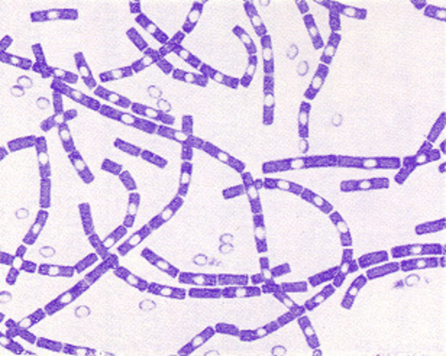 <p>boil bacteria, endospore former, gram negative</p>